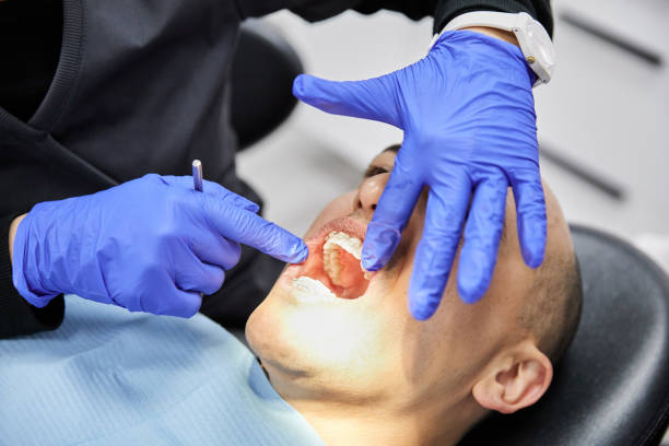 Best Emergency Wisdom Teeth Removal in Hemlock, MI